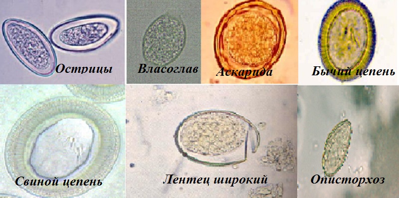 Яйца паразитов под микроскопом