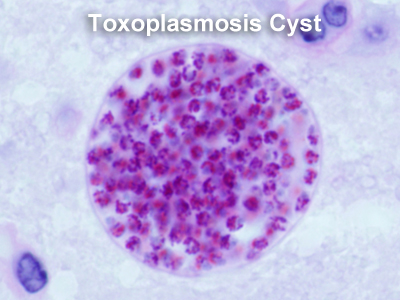 Toxoplasma gondii и что значит положительный анализ на антитела IgG? 
