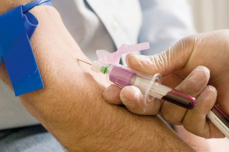 Взятие крови для диагностики токсоплазмоза