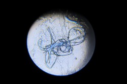 Вирус Моргеллона под микроскопом