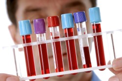 Иммуноферментный анализ крови на антитела к лямблиям
